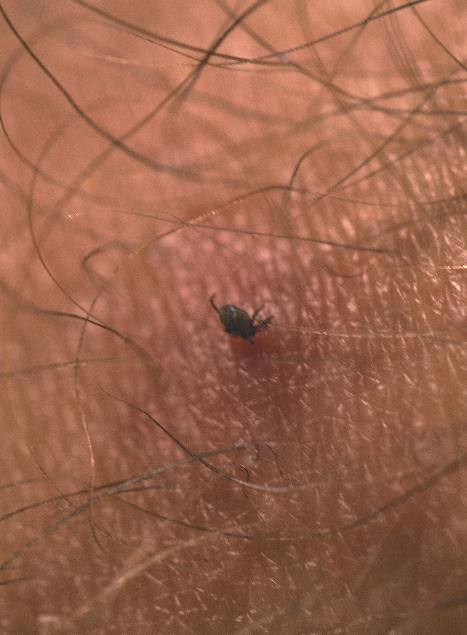 Уред за отстраняване на кърлежи Lifesystems Tick Remover Card
